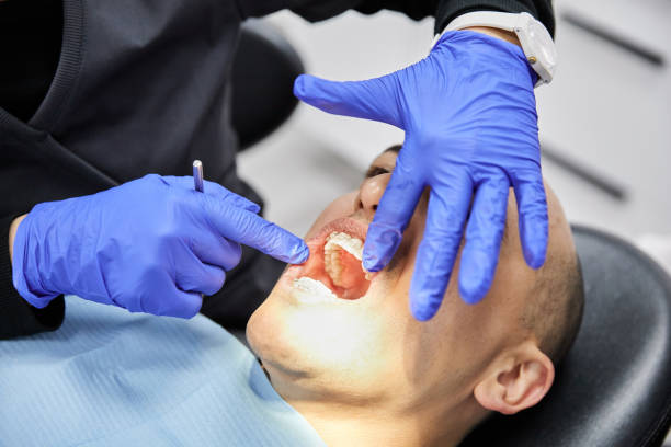 Best Emergency Root Canal Treatment in Weddington, NC
